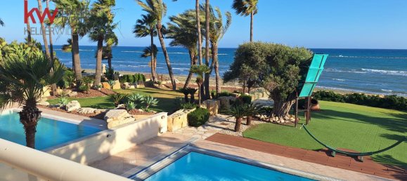 4 dormitorios villa en venta en Softades, Larnaka, Cyprus № 26666 25